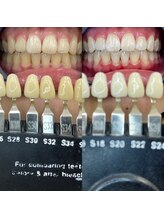 トウキョウスワーズ 池袋店(TOKYO SWRS)/#ホワイトニング #池袋 #渋谷