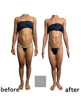 マロン(marron)/痩身ハイパーナイフ×キャビ