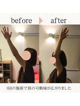 ハリング(HARIING)/初回からこの変化