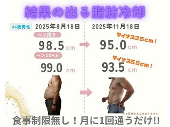 ココ(Coco)/脂肪冷却／皮下脂肪撃退