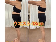 シュシュ