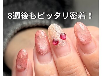 ビューイング(美ing)の写真/悩みを解消!4週間で浮いていたストレスネイルがストレスフリーの指先に!