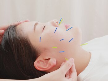 フォーユー鍼灸整骨院 津久野院(for you 鍼灸整骨院)/美容鍼灸イメージ