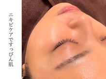 ウォーム(warm)/【肌質改善専門店warm】小顔