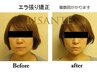 回数券ご購入者の専用予約クーポン★小顔矯正＋骨盤・骨格矯正など70分コース