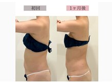 フロリール アザブジュウバン(FlorirAzabujuban)/痩身/脂肪燃焼/くびれ美人