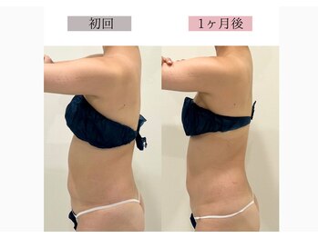 フロリール アザブジュウバン(FlorirAzabujuban)/痩身/脂肪燃焼/くびれ美人