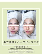 ソワナ(soina)/【神楽坂駅/フェイシャル/毛穴】