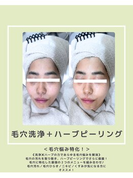 ソワナ(soina)/【神楽坂駅/フェイシャル/毛穴】