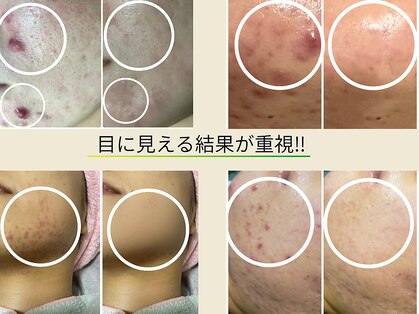 ルナティアラ(LUNAティアラ)の写真