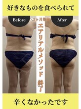 エアリアル 大牟田店/ダイエット モニター様