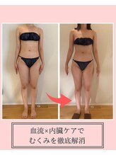 サクラ(SAKURA)/臓活ビフォーアフター