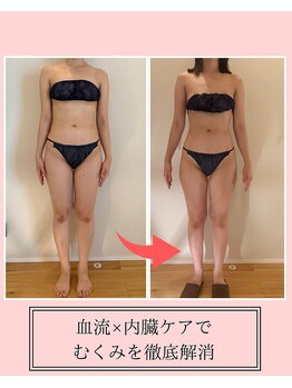 サクラ(SAKURA)/臓活ビフォーアフター