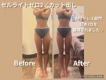 ボディリカバリー(Bodyリカバリー)/