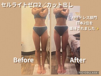 ボディリカバリー(Bodyリカバリー)/