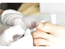 巻き爪/陥入爪/深爪/自爪育成/ハンドケア/フットケア/よもぎ蒸し