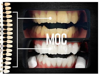 モック 麻布十番(MOC)/ホワイトニング/麻布十番/六本木