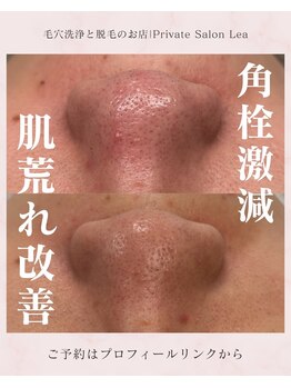 レア(Lea)/月1のメンテナンスに最適＊