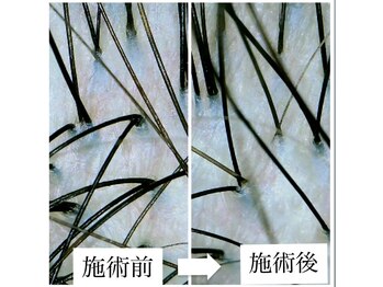 アンジール(ANJIR)/赤い頭皮