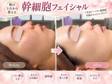 イーネオランジェ 阿佐ヶ谷店の雰囲気（話題の幹細胞と大人気ハイドロで肌質改善）