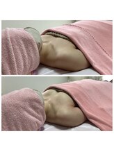 エジュール(EJURE)/ミラクルバストビフォーアフター