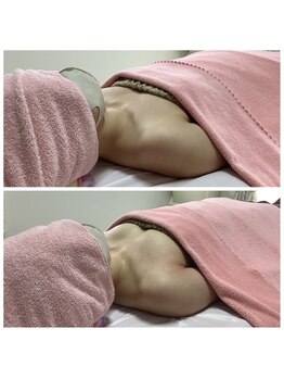 エジュール(EJURE)/ミラクルバストビフォーアフター