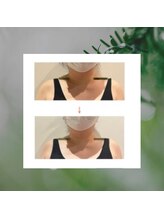 サロン ド リアン(Salon de lien)/首の施術を右のみした結果◎