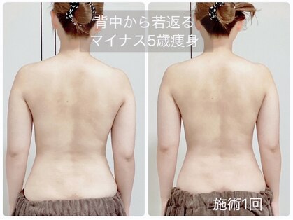 ビュー(Beau)の写真