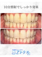 アトリエ 横浜店/ホワイトニングサロン/横浜