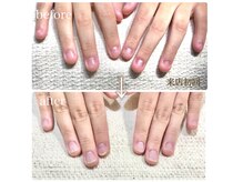 アンドチル(&chill)の雰囲気（深爪矯正大人気！お悩み解消で美フォルムなお手元に仕上げます！）