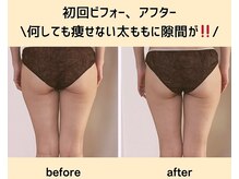 ヨサパーク ルアナ(YOSAPARK Luana)/初回で、太ももにスキマ！