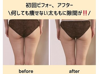 ヨサパーク ルアナ(YOSAPARK Luana)/初回で、太ももにスキマ!