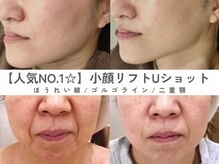 エス(es)の雰囲気（最新超音波ケア☆Ｕショットでたるみのない小顔に！）