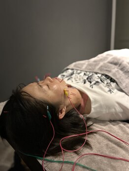 シャルム(CHARMEB)/電気を流して小顔に美容鍼