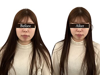 整体と美容鍼 無名/Before&After【心斎橋/南船場】