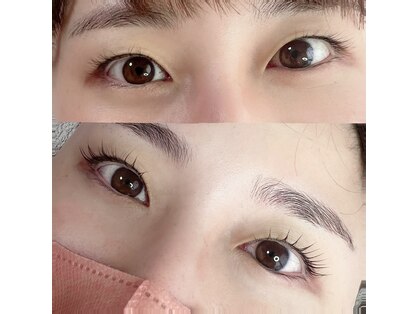 シュシュ(chouchou)の写真