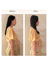 ミマノ 調布(MimanoChofu)/ビフォー＆アフター/マタニティ