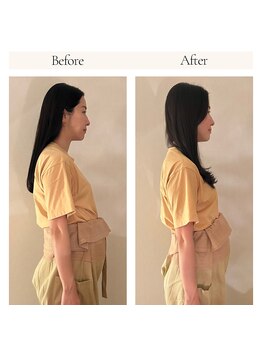 ミマノ 調布(MimanoChofu)/ビフォー＆アフター/マタニティ