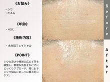 ルディラ 町田店/水光肌フェイシャル