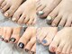 エムジーネイル(Mg Nail)の写真