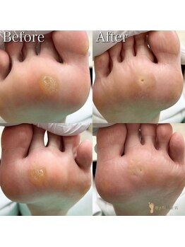 巻き爪補正店 横浜駅前店/