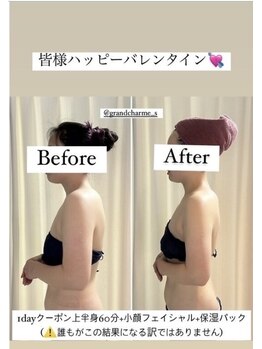 グランドシャルムエス(Grand Charme S)/南森町/直前ブライダルエステ