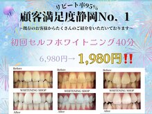 ホワイトニングショップ 葵区静岡駅店/ホワイトニング店ホワイトニング