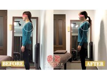 【小顔/リフトアップ/姿勢/骨盤矯正/頭蓋骨/痩身】ヴィオーデ美容整体サロン那覇店/小顔、リンパ、ヘッドスパ、骨盤