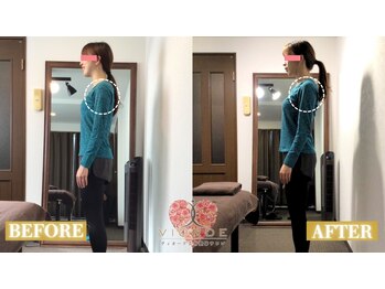 【小顔/リフトアップ/姿勢/骨盤矯正/頭蓋骨/痩身】ヴィオーデ美容整体サロン那覇店/小顔、リンパ、ヘッドスパ、骨盤