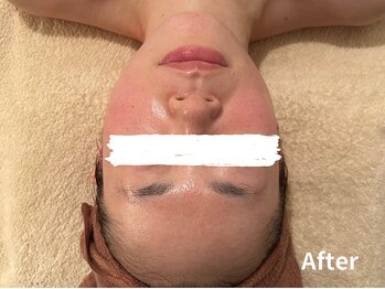 ダイヤモンド リーエンダ(Diamond leende)/クレイハーブピーリング