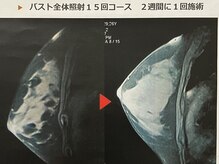 アトレ(attrait)の雰囲気（血液やリンパの流れ、脂肪細胞を活性化！ふっくらしたバストに）