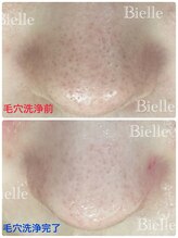 ビエル(Bielle)/居座る目立つ毛穴をなんとかして