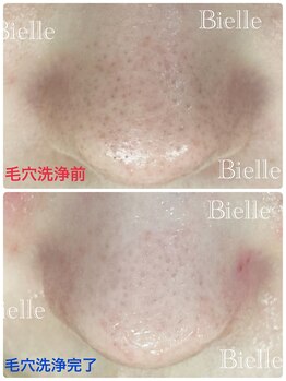 ビエル(Bielle)/居座る目立つ毛穴をなんとかして