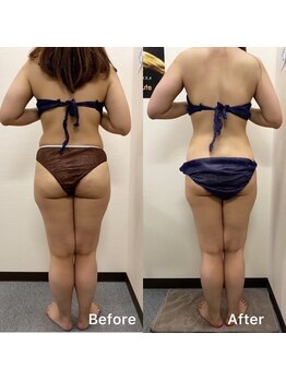 きれい塾 恵比寿/30代３ヶ月後